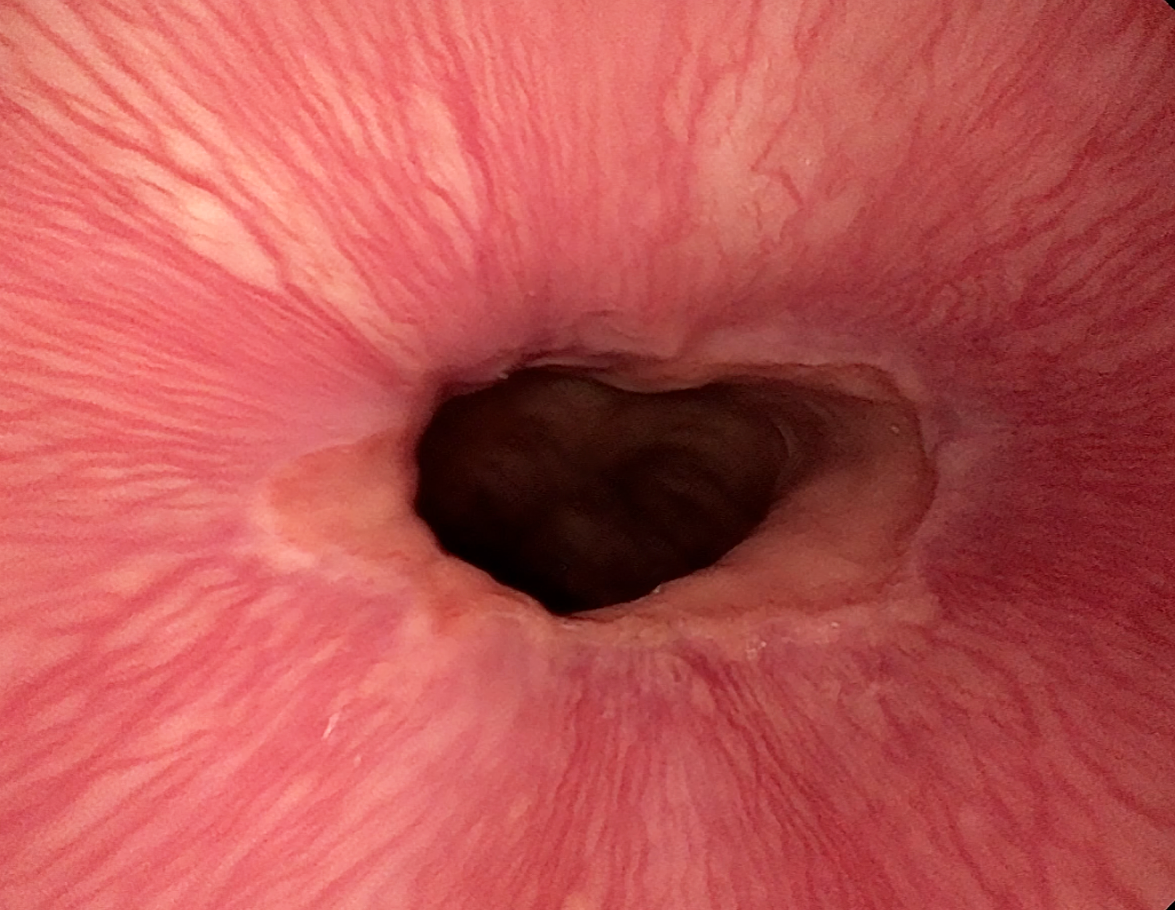 Full HD imaging